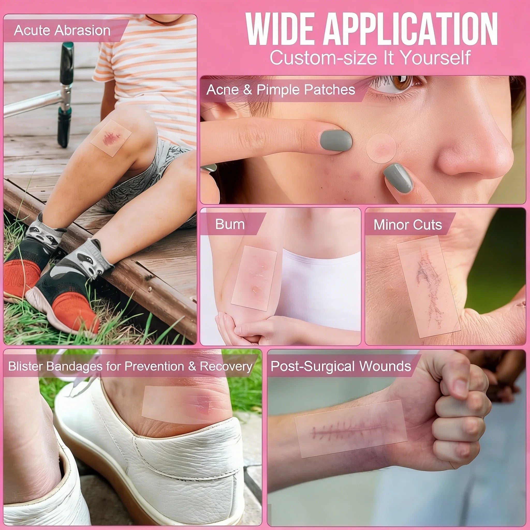 40pcs pieces of multi-color star acne patches, facial acne patches, concealer acne patches, and pimples patches, ultra-thin.